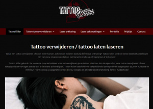 Tattoo verwijderen Tattoo Killer Kampen